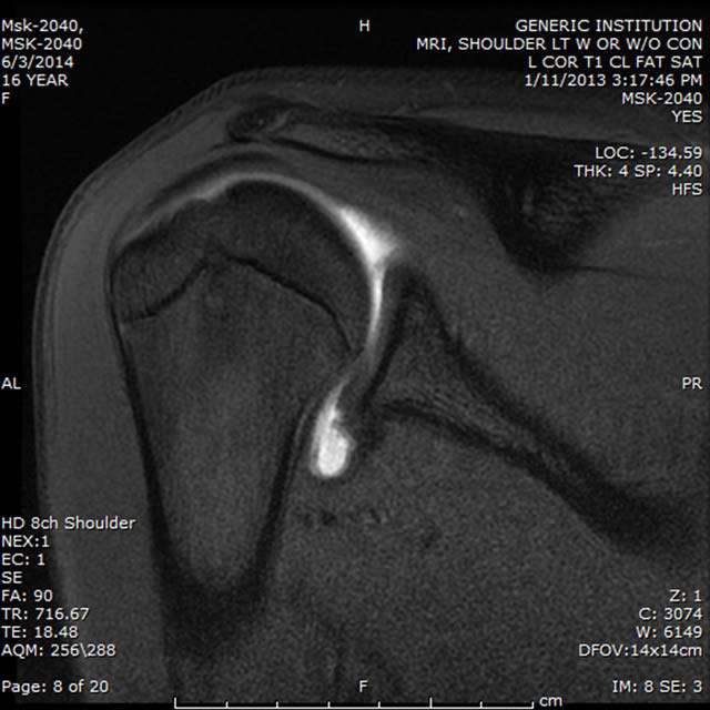 MSK MR Large Joints American College of Radiology